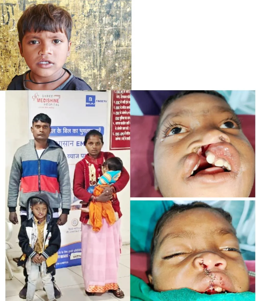 खिलखिलाती मुस्कान की नई इबारत लिख रहा बस्तर के वनांचल से नन्हा विक्रम