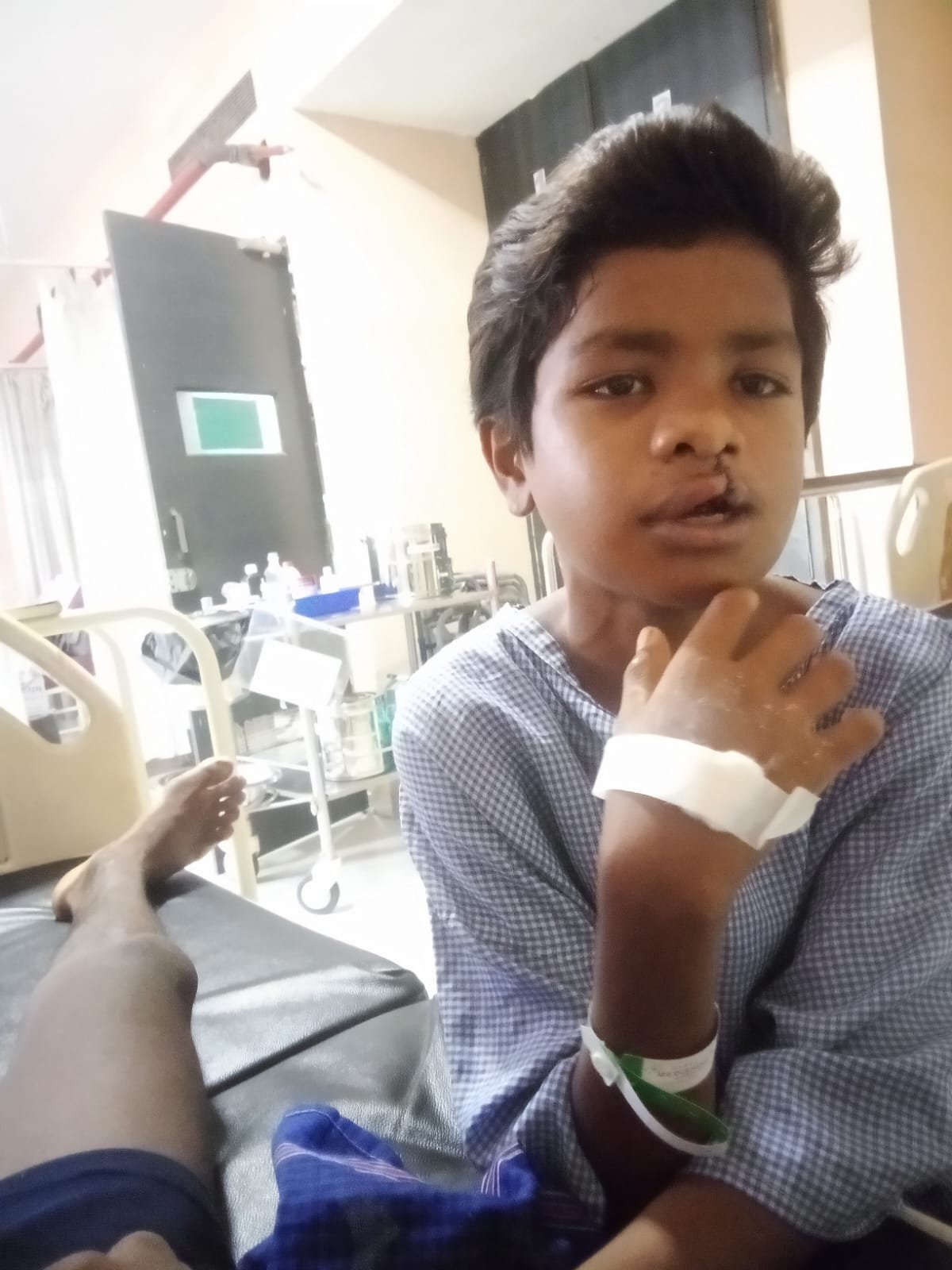 चिरायु' दल ने लौटाई मुस्कान, जन्मजात कटे होंठ और तालु से मिली मुक्ति
